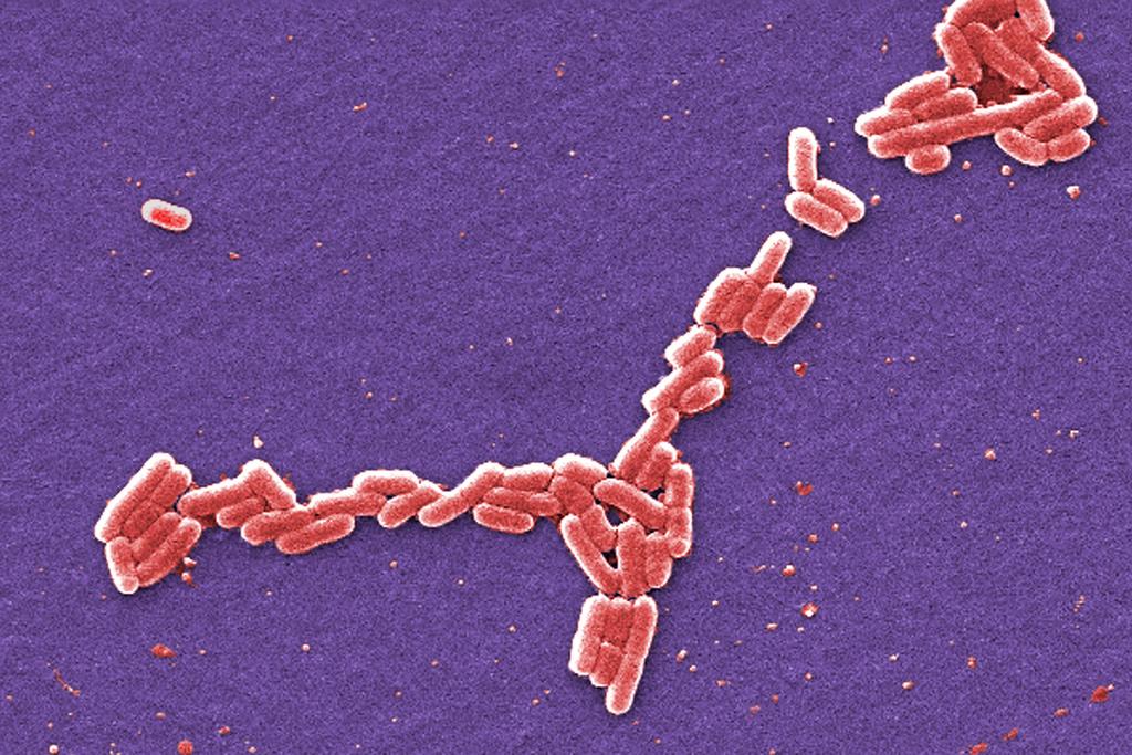  E. coli bacteria image
