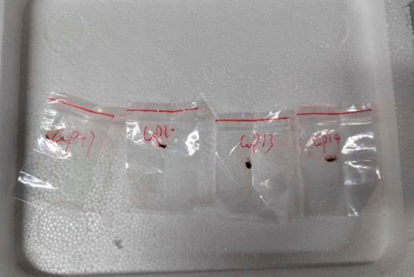 Toxic plant pathogens that a Chinese scientist entered the U.S. stashed in his backpack