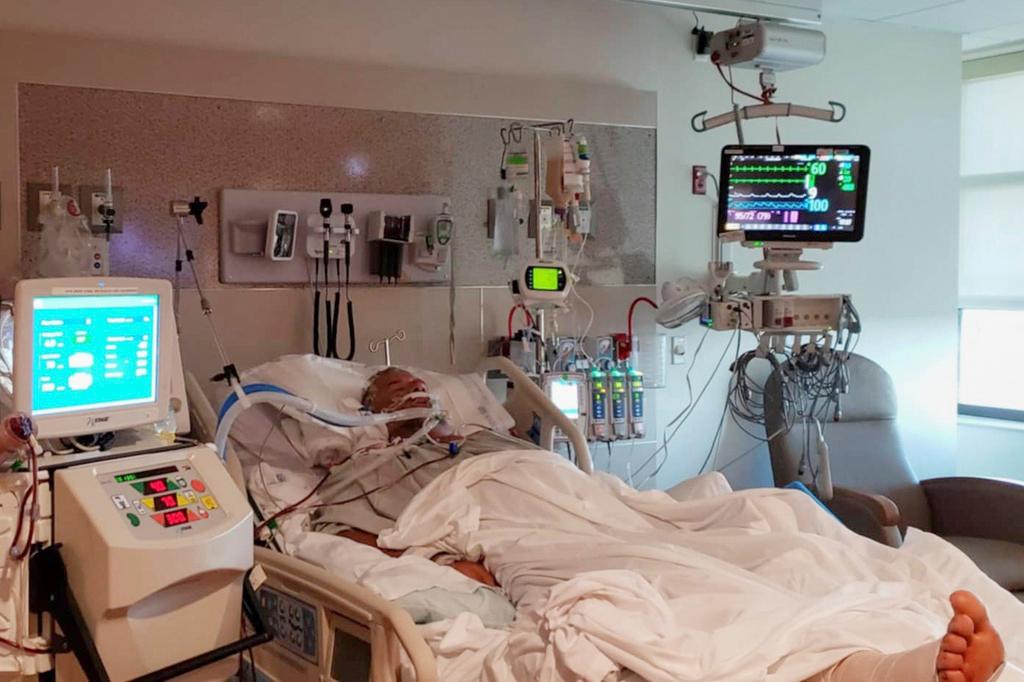 Bernie Stewart, in a coma at a hospital in Pensacola, Fla., shortly after the start of an August 2019 Vibrio infection.