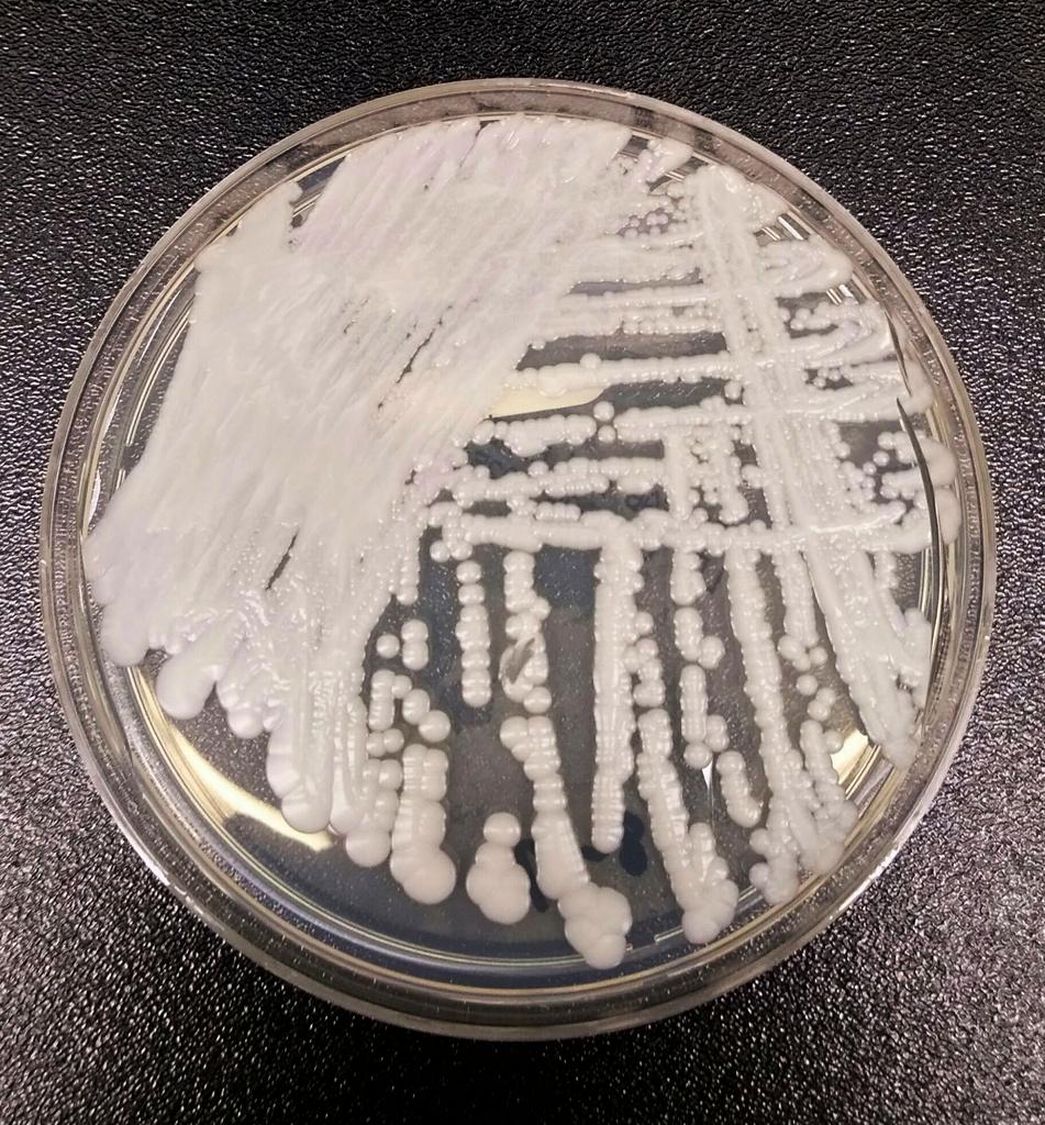 A strain of Candida auris cultured in a petri dish at a CDC laboratory