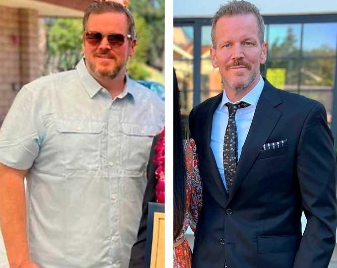 Before and after pictures of Matthew Barlow. Barlow lost over 100 pounds using the drug Mounjaro, and changing his diet