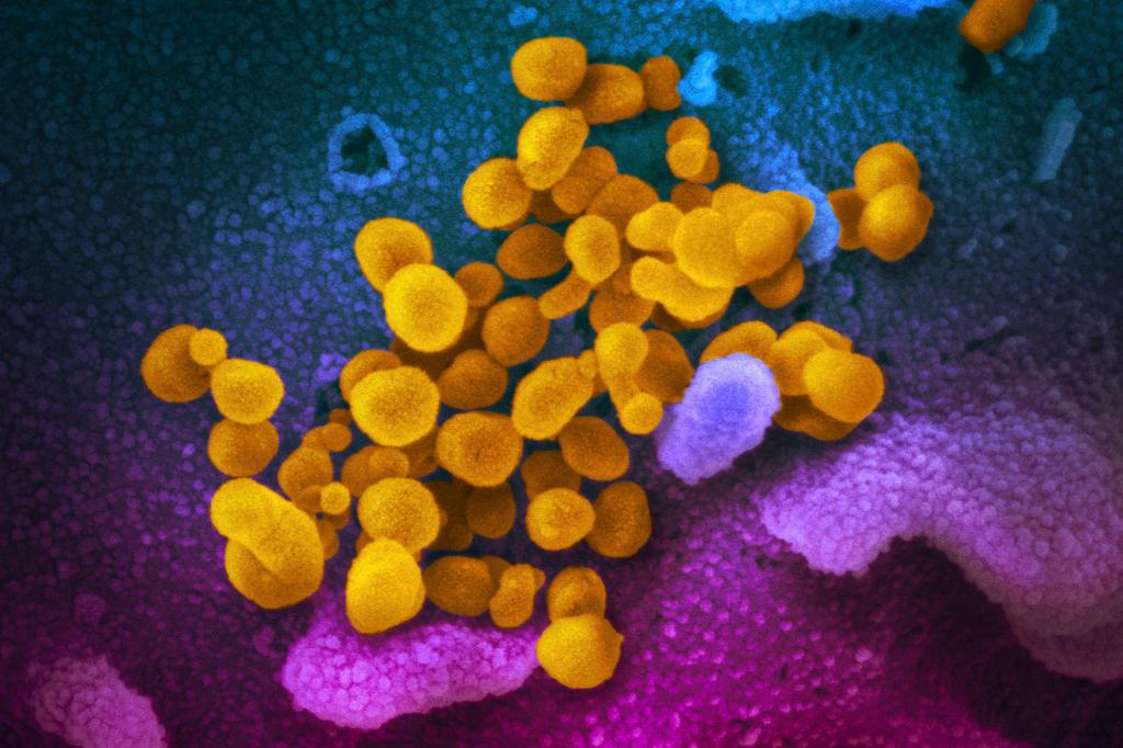 Novel Coronavirus SARS-CoV-2 (COVID)