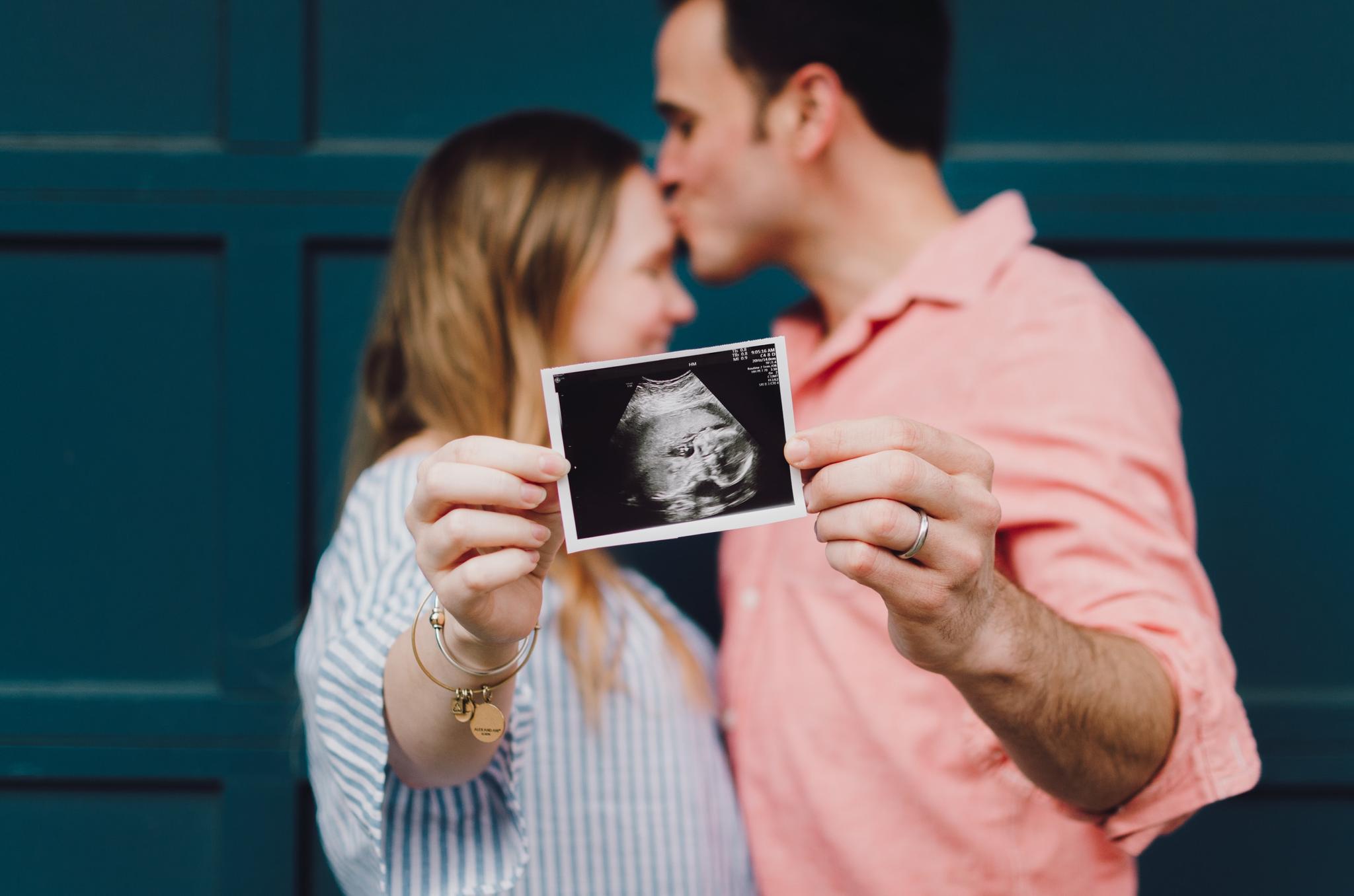 couple announcing pregnancy baby ultrasound 