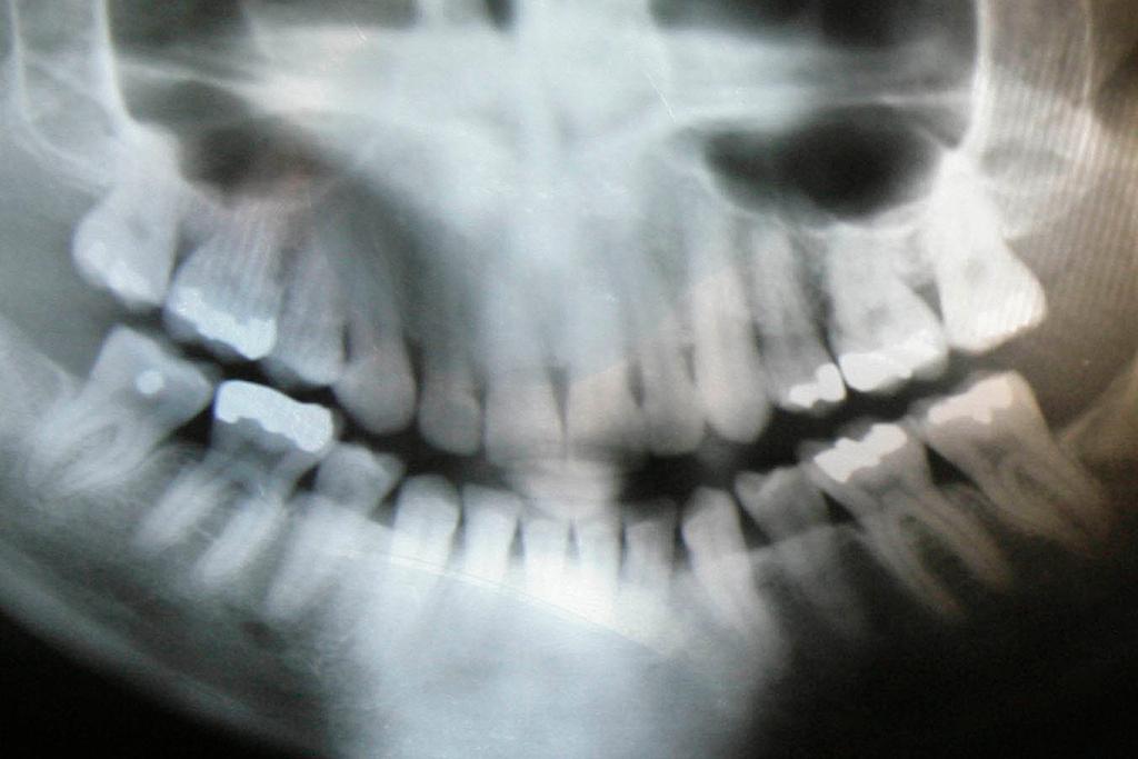 A dental X-ray