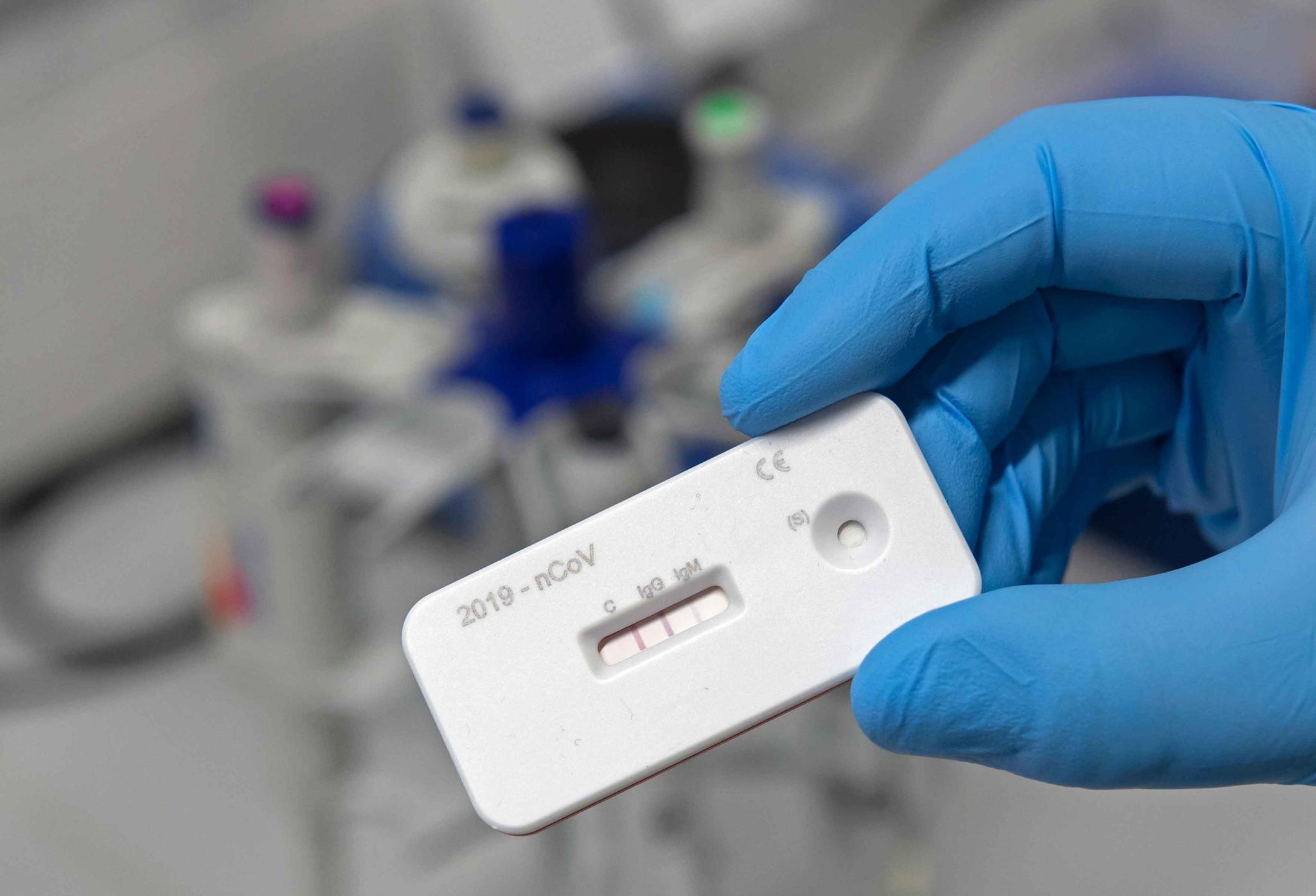 An antibody test for COVID-19 Coronavirus