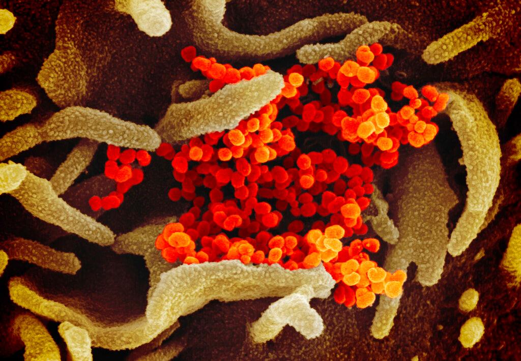 COVID-19 virus 