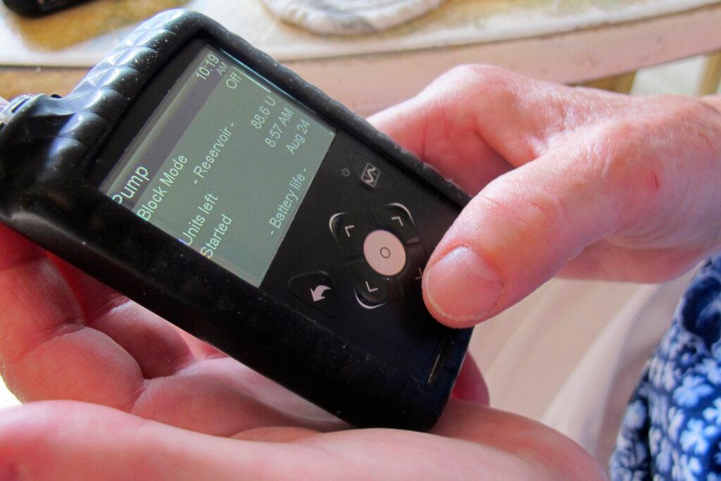 In this Aug. 24, 2020, photo Jean Grady wears an insulin pump to help manage her diabetes at her home in Westford, Vt. Before the pandemic, Medicare rules required her make regular two-hour, one-way trips to New Hampshire to meet with her doctor to discuss her treatment. Medicare rule changes during the pandemic now makes it possible for her to meet with her doctor remotely, saving her from hours on the road.