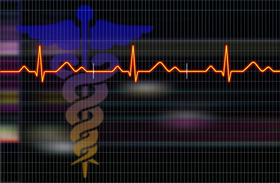 Cardiogram