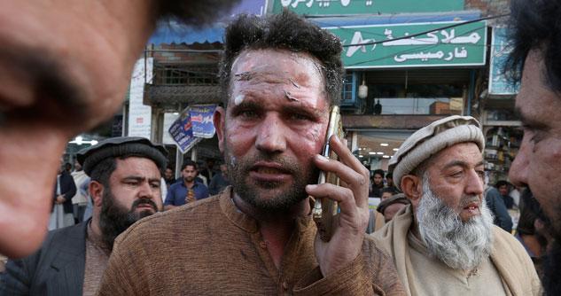 Battered man holds a cell phone to his face with many men in the background