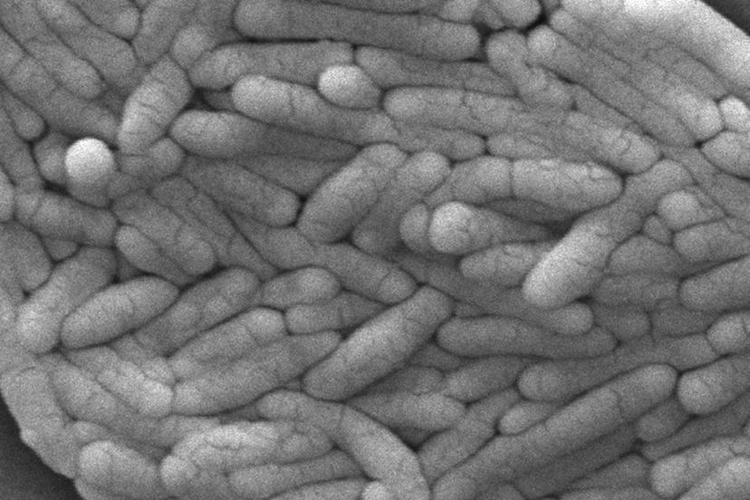 This 2009 electron microscope image provided by the Centers for Disease Control and Prevention shows a large group of Gram-negative Salmonella typhimurium bacteria